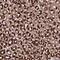 TM2 Domain Containing 2 antibody, HPA047152, Atlas Antibodies, Immunohistochemistry frozen image 