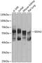 Sestrin 2 antibody, GTX64418, GeneTex, Western Blot image 