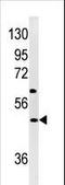 Neuronal Pentraxin 1 antibody, LS-C100843, Lifespan Biosciences, Western Blot image 