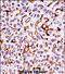 Macrophage Stimulating 1 Receptor antibody, PA5-71878, Invitrogen Antibodies, Immunohistochemistry paraffin image 