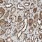 Tousled Like Kinase 1 antibody, NBP1-83035, Novus Biologicals, Immunohistochemistry paraffin image 