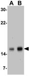 Baculoviral IAP Repeat Containing 5 antibody, GTX31651, GeneTex, Western Blot image 