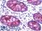 CTR1 antibody, LS-B9488, Lifespan Biosciences, Immunohistochemistry paraffin image 