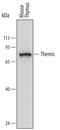 Thymocyte Selection Associated antibody, MAB6816, R&D Systems, Western Blot image 