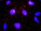 CD82 Molecule antibody, H00003732-M01, Novus Biologicals, Proximity Ligation Assay image 