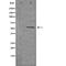 Cholinergic Receptor Nicotinic Beta 1 Subunit antibody, orb226249, Biorbyt, Western Blot image 