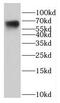 Dystrobrevin beta antibody, FNab02551, FineTest, Western Blot image 