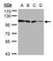 Hexokinase 1 antibody, PA5-28217, Invitrogen Antibodies, Western Blot image 