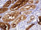 Gamma-Butyrobetaine Hydroxylase 1 antibody, LS-C174481, Lifespan Biosciences, Immunohistochemistry paraffin image 