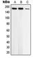 DNA Topoisomerase II Beta antibody, orb214690, Biorbyt, Western Blot image 