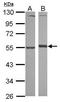 Alpha-1-antitrypsin antibody, GTX112707, GeneTex, Western Blot image 