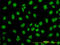 WD Repeat Domain 20 antibody, LS-B4542, Lifespan Biosciences, Immunofluorescence image 