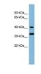 DnaJ Heat Shock Protein Family (Hsp40) Member C27 antibody, NBP1-58940, Novus Biologicals, Western Blot image 