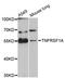 TNF Receptor Superfamily Member 1A antibody, STJ25891, St John