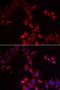 PHS antibody, LS-C334681, Lifespan Biosciences, Immunofluorescence image 