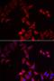 Pterin-4 Alpha-Carbinolamine Dehydratase 1 antibody, LS-C334681, Lifespan Biosciences, Immunofluorescence image 