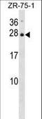 Interleukin 25 antibody, LS-C165200, Lifespan Biosciences, Western Blot image 