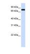 Zinc Finger FYVE-Type Containing 1 antibody, NBP1-79427, Novus Biologicals, Western Blot image 