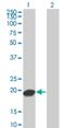 UBE2C antibody, H00011065-M04, Novus Biologicals, Western Blot image 