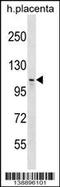 MMS19 Homolog, Cytosolic Iron-Sulfur Assembly Component antibody, 60-132, ProSci, Western Blot image 