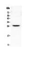 Fms Related Tyrosine Kinase 3 Ligand antibody, PA5-79273, Invitrogen Antibodies, Western Blot image 