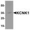 Potassium Two Pore Domain Channel Subfamily K Member 1 antibody, MBS153487, MyBioSource, Western Blot image 