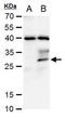 Stanniocalcin 1 antibody, PA5-35990, Invitrogen Antibodies, Western Blot image 