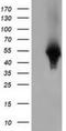 Haptoglobin antibody, NBP2-03008, Novus Biologicals, Western Blot image 