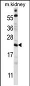 Tetratricopeptide Repeat Domain 33 antibody, PA5-71930, Invitrogen Antibodies, Western Blot image 