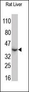 C-C Motif Chemokine Receptor 5 (Gene/Pseudogene) antibody, 251837, Abbiotec, Western Blot image 