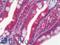 Phosphofructokinase, Muscle antibody, LS-B10796, Lifespan Biosciences, Immunohistochemistry frozen image 