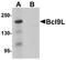 B-cell CLL/lymphoma 9-like protein antibody, A05905-1, Boster Biological Technology, Western Blot image 