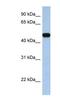 Solute carrier family 25 member 46 antibody, NBP1-59604, Novus Biologicals, Western Blot image 