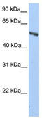 Inosine Monophosphate Dehydrogenase 2 antibody, TA336213, Origene, Western Blot image 