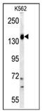 Phosphatidylinositol-4,5-Bisphosphate 3-Kinase Catalytic Subunit Gamma antibody, AP14936PU-N, Origene, Western Blot image 