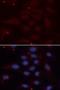 Karyopherin Subunit Alpha 1 antibody, LS-C331667, Lifespan Biosciences, Immunofluorescence image 