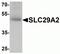 Solute Carrier Family 29 Member 2 antibody, NBP2-81984, Novus Biologicals, Western Blot image 