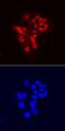 Chromodomain Helicase DNA Binding Protein 7 antibody, MAB7350, R&D Systems, Immunofluorescence image 