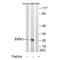 Empty Spiracles Homeobox 1 antibody, A06307, Boster Biological Technology, Western Blot image 