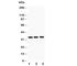 Colony Stimulating Factor 2 antibody, R30528, NSJ Bioreagents, Western Blot image 