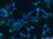 Golgi Associated PDZ And Coiled-Coil Motif Containing antibody, 12163-1-AP, Proteintech Group, Immunofluorescence image 