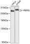 Pre-MRNA Processing Factor 8 antibody, GTX65909, GeneTex, Western Blot image 