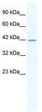 Gamma-Aminobutyric Acid Type A Receptor Alpha3 Subunit antibody, TA338502, Origene, Western Blot image 