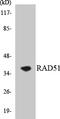 RAD51 Recombinase antibody, LS-C200561, Lifespan Biosciences, Western Blot image 