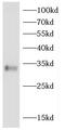 Immune receptor expressed on myeloid cells 1 antibody, FNab01461, FineTest, Western Blot image 