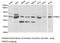 Protein Arginine Methyltransferase 5 antibody, LS-C193004, Lifespan Biosciences, Western Blot image 