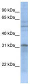 Mitochondrial Carrier 2 antibody, TA334519, Origene, Western Blot image 