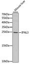 Interleukin-28B antibody, STJ27615, St John