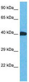 Zinc Finger Protein 883 antibody, TA329369, Origene, Western Blot image 