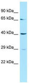 Uroporphyrinogen Decarboxylase antibody, TA346182, Origene, Western Blot image 